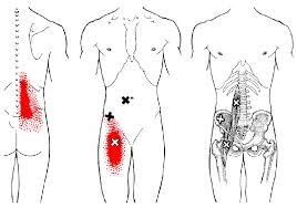 Iliopsoas Referral Pattern