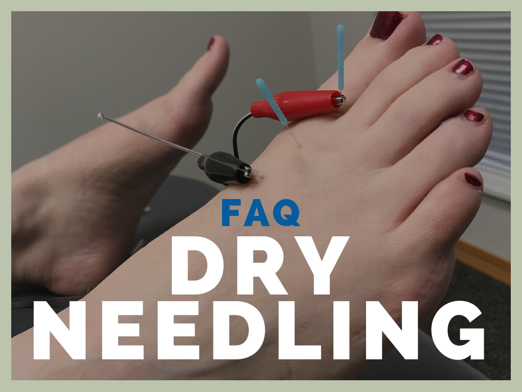 Faq dry needling